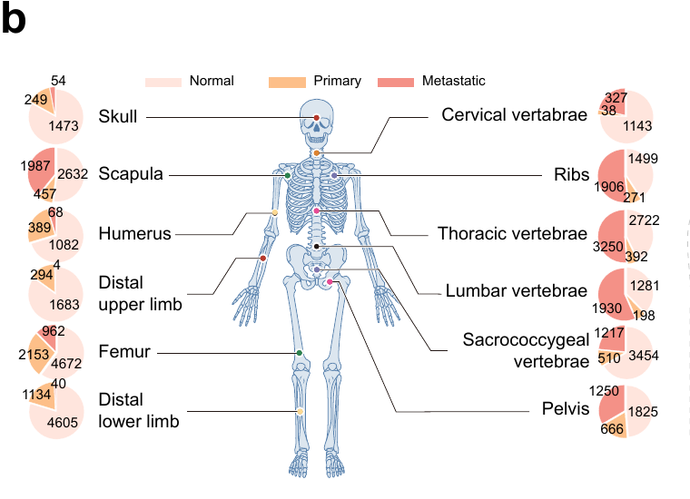 Figure 1b showing skeletal distribution across normal, primary, and metastatic cohorts.